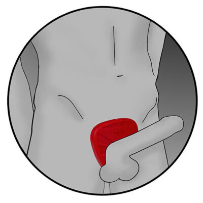 Escudo de vibre de fusão de silicone eletrastim electrastim caliente. Pt